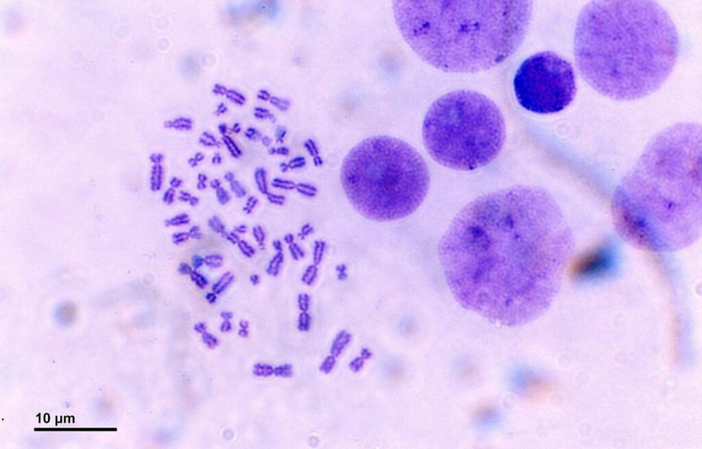 Light micrograph of stained human chromosomes in a metaphase spread beside cell nuclei